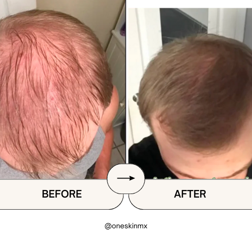 Shampoo con Minoxidil, Biotina & Bergamota 250ml