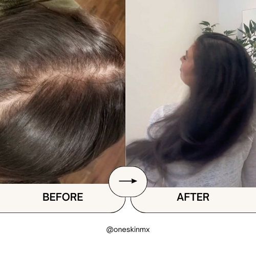 Shampoo con Minoxidil, Biotina & Bergamota 250ml