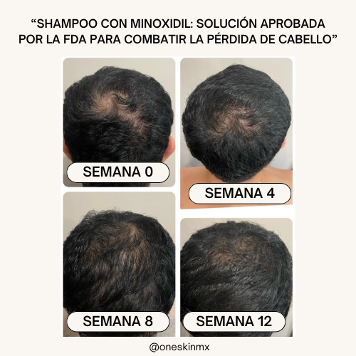 Shampoo con Minoxidil, Biotina & Bergamota 250ml